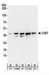 CDK7 Antibody - Detection of Mouse and Rat CDK7 by Western Blot. Samples: Whole cell lysate (50 ug) from NIH3T3, TCMK-1, 4T1, CT26.WT, and rat C6 cells. Antibodies: Affinity purified rabbit anti-CDK7 antibody used for WB at 1 ug/ml. Detection: Chemiluminescence with an exposure time of 30 seconds.