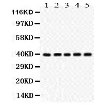 CDK7 Antibody - Cdk7 antibody Western blot. All lanes: Anti Cdk7 at 0.5 ug/ml. Lane 1: MCF-7 Whole Cell Lysate at 40 ug. Lane 2: HELA Whole Cell Lysate at 40 ug. Lane 3: A549 Whole Cell Lysate at 40 ug. Lane 4: HEPG2 Whole Cell Lysate at 40 ug. Lane 5: 293T Whole Cell Lysate at 40 ug. Predicted band size: 39 kD. Observed band size: 39 kD.
