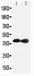 CDK7 Antibody - Cdk7 antibody Western blot. Lane 1: Rat Testis Tissue Lysate. Lane 2: Rat Ovary Tissue Lysate.
