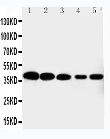 CDK7 Antibody - Cdk7 antibody Western blot. Lane 1: HELA Cell Lysate. Lane 2: MCF-7 Cell Lysate. Lane 3: A549 Cell Lysate. Lane 4: COLO320 Cell Lysate. Lane 5: JURKAT Cell Lysate.
