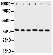 CDK7 Antibody - Cdk7 antibody Western blot. Lane 1: Rat Testis Tissue Lysate. Lane 2: Rat Ovary Tissue Lysate. Lane 3: HELA Cell Lysate. Lane 4: MCF-7 Cell Lysate. Lane 5: A549 Cell Lysate. Lane 6: COLO320 Cell Lysate.