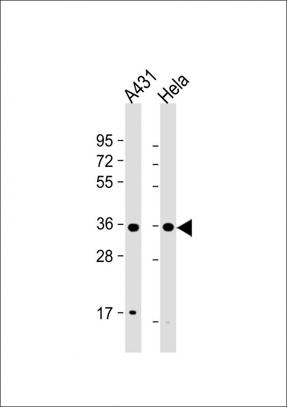 CDK7 Antibody - All lanes: Anti-Cdk7 Antibody (T170) at 1:1000 dilution Lane 1: A431 whole cell lysate Lane 2: Hela whole cell lysate Lysates/proteins at 20 µg per lane. Secondary Goat Anti-Rabbit IgG, (H+L), Peroxidase conjugated at 1/10000 dilution. Predicted band size: 39 kDa Blocking/Dilution buffer: 5% NFDM/TBST.