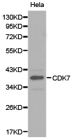 CDK7 Antibody - Western blot of extracts of HeLa cell line, using CDK7 antibody.