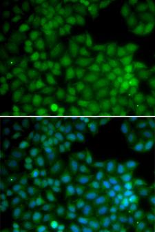 CDK7 Antibody - Immunofluorescence analysis of U20S cells.