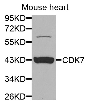 CDK7 Antibody - Western blot analysis of extracts of mouse heart, using CDK7 antibody at 1:1000 dilution. The secondary antibody used was an HRP Goat Anti-Rabbit IgG (H+L) at 1:10000 dilution. Lysates were loaded 25ug per lane and 3% nonfat dry milk in TBST was used for blocking.