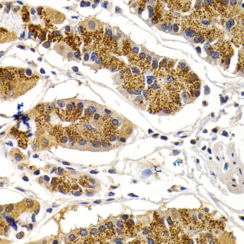 CDK7 Antibody - Immunohistochemistry of paraffin-embedded human stomach using CDK7 antibodyat dilution of 1:200 (40x lens).