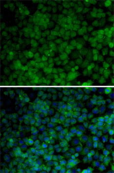 CDK7 Antibody - Immunofluorescence analysis of HeLa cells using CDK7 antibody. Blue: DAPI for nuclear staining.