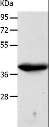CDK7 Antibody - Western blot analysis of A549 cell, using CDK7 Polyclonal Antibody at dilution of 1:500.
