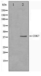 CDK7 Antibody - Western blot of HeLa cell lysate using CDK7 Antibody