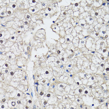 CDK7 Antibody - Immunohistochemistry of paraffin-embedded human liver using CDK7 antibody at dilution of 1:150 (40x lens).
