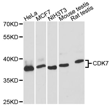 CDK7 Antibody - Western blot analysis of extracts of various cell lines, using CDK7 antibody at 1:3000 dilution. The secondary antibody used was an HRP Goat Anti-Rabbit IgG (H+L) at 1:10000 dilution. Lysates were loaded 25ug per lane and 3% nonfat dry milk in TBST was used for blocking. An ECL Kit was used for detection and the exposure time was 90s.
