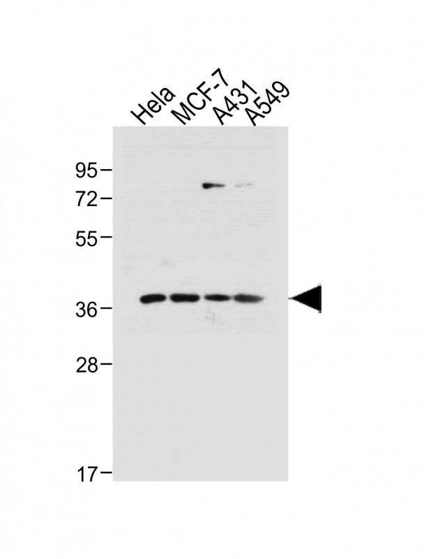 CDK7 Antibody - All lanes: Anti-hCdk7-T170 at 1:1000 dilution Lane 1: Hela whole cell lysate Lane 2: MCF-7 whole cell lysate Lane 3: A431 whole cell lysate Lane 4: A549 whole cell lysate Lysates/proteins at 20 µg per lane. Secondary Goat Anti-Rabbit IgG, (H+L), Peroxidase conjugated at 1/10000 dilution. Predicted band size: 39 kDa Blocking/Dilution buffer: 5% NFDM/TBST.