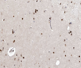 CDK7 Antibody - 1:100 staining human brain tissue by IHC-P. The tissue was formaldehyde fixed and a heat mediated antigen retrieval step in citrate buffer was performed. The tissue was then blocked and incubated with the antibody for 1.5 hours at 22°C. An HRP conjugated goat anti-rabbit antibody was used as the secondary.