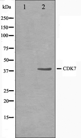 CDK7 Antibody - Western blot analysis on HeLa cell lysates using CDK7 antibody. The lane on the left is treated with the antigen-specific peptide.