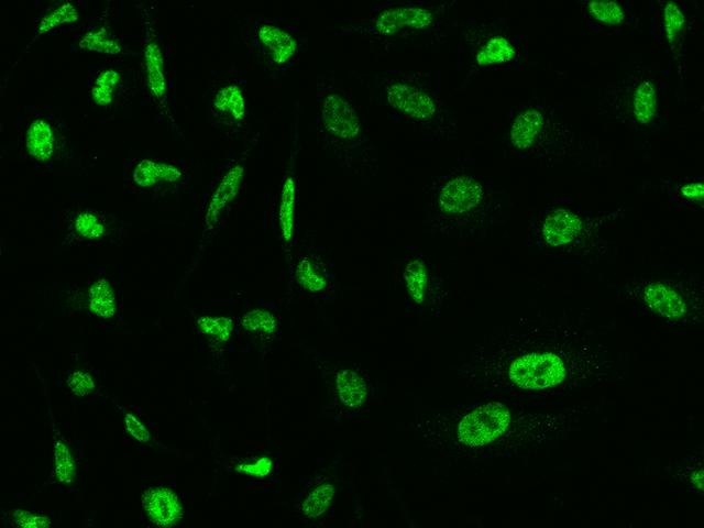 CDK7 Antibody - Immunofluorescence staining of CDK7 in Hela cells. Cells were fixed with 4% PFA, permeabilzed with 0.1% Triton X-100 in PBS, blocked with 10% serum, and incubated with rabbit anti-Human CDK7 polyclonal antibody (dilution ratio 1:200) at 4°C overnight. Then cells were stained with the Alexa Fluor 488-conjugated Goat Anti-rabbit IgG secondary antibody (green). Positive staining was localized to Nucleus.