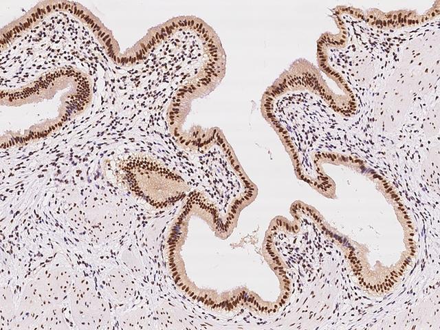 CDK7 Antibody - Immunochemical staining of human CDK7 in human gallbladder with rabbit polyclonal antibody at 1:100 dilution, formalin-fixed paraffin embedded sections.