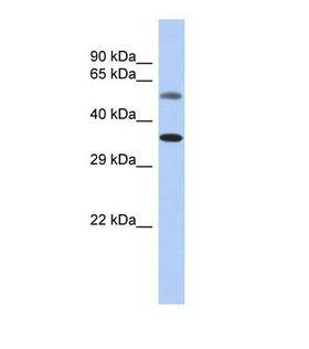 CDK7 Antibody - Western blot of Human Fetal Kidney. CDK7 antibody dilution 1.0 ug/ml.  This image was taken for the unconjugated form of this product. Other forms have not been tested.