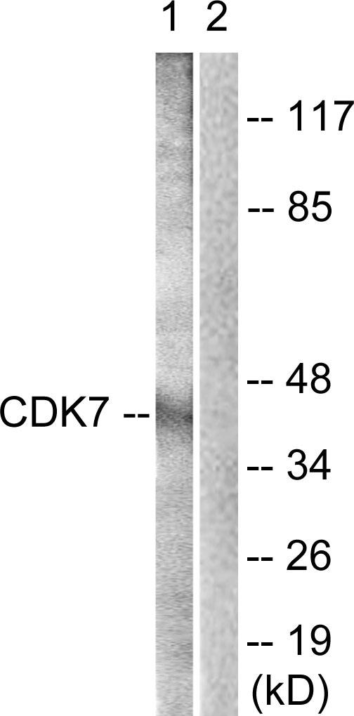 CDK7 Antibody - Western blot analysis of extracts from Raw264.7 cells, treated with Calyculin A (50ng/ml, 30mins), using CDK7 (Ab-170) antibody.