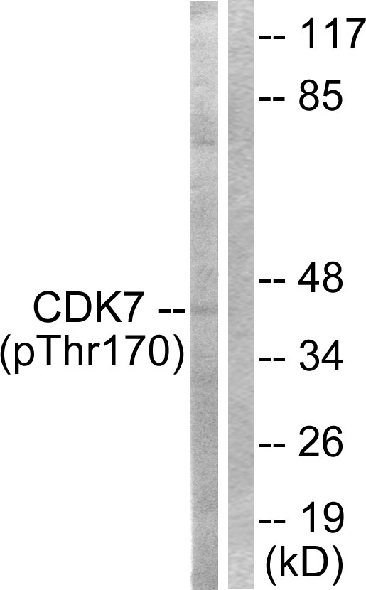 CDK7 Antibody - Western blot analysis of lysates from HeLa cells treated with Calyculin A 50nM 30', using CDK7 (Phospho-Thr170) Antibody. The lane on the right is blocked with the phospho peptide.