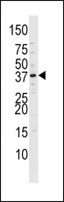 CDK7 Antibody - The CDK7-T170 antibody is used in Western blot to detect CDK7-T170 in Ramos tissue lysate.