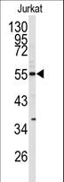 CDK8 Antibody - Western blot of CDK8 antibody in Jurkat cell line lysates (35 ug/lane). CDK8 (arrow) was detected using the purified antibody.