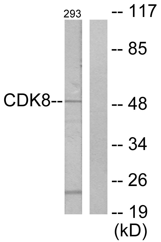 CDK8 Antibody - Western blot analysis of lysates from 293 cells, using CDK8 Antibody. The lane on the right is blocked with the synthesized peptide.