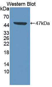 CDK8 Antibody - Western blot of CDK8 antibody.