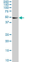 CDK8 Antibody - CDK8 monoclonal antibody (M01), clone 6H5. Western Blot analysis of CDK8 expression in PC-12.