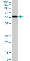 CDK8 Antibody - CDK8 monoclonal antibody (M01), clone 6H5. Western Blot analysis of CDK8 expression in Jurkat.