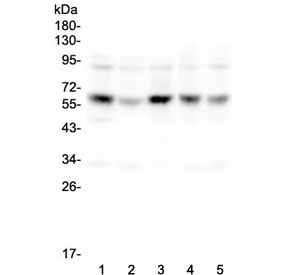 CDK8 Antibody - Western blot testing of human 1) K562, 2) HL-60, 3) Caco-2, 4) HEK293 and 5) HeLa lysate with CDK8 antibody at 0.5ug/ml. Predicted molecular weight ~53 kDa.