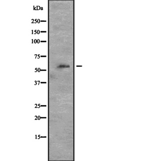 CDK8 Antibody - Western blot analysis of CDK8 expression in HeLa cells lysate. The lane on the left is treated with the antigen-specific peptide.