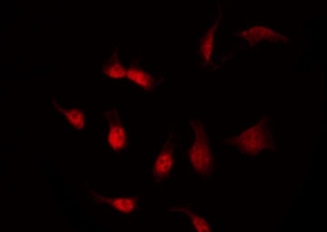 CDK8 Antibody - Staining 293 cells by IF/ICC. The samples were fixed with PFA and permeabilized in 0.1% Triton X-100, then blocked in 10% serum for 45 min at 25°C. The primary antibody was diluted at 1:200 and incubated with the sample for 1 hour at 37°C. An Alexa Fluor 594 conjugated goat anti-rabbit IgG (H+L) Ab, diluted at 1/600, was used as the secondary antibody.