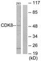 CDK8 Antibody - Western blot analysis of extracts from 293 cells, using CDK8 antibody.