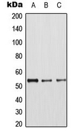CDK8 Antibody - Western blot analysis of CDK8 expression in HepG2 (A); A549 (B); Raw264.7 (C) whole cell lysates.