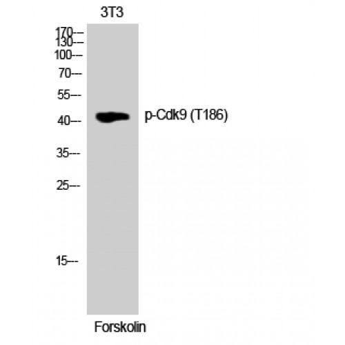 CDK9 Antibody - Western blot of Phospho-Cdk9 (T186) antibody