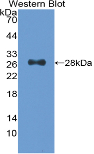 CDK9 Antibody - Western blot of CDK9 antibody.