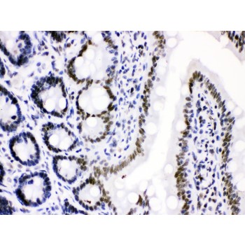 CDK9 Antibody - Cdk9 antibody IHC-paraffin. IHC(P): Rat Intestine Tissue.