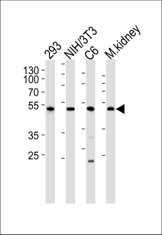 CDK9 Antibody - Western blot of lysates from 293, mouse NIH/3T3, rat C6 cell line and mouse kidney tissue lysate(from left to right), using Mouse Cdk9 Antibody. Antibody was diluted at 1:1000 at each lane. A goat anti-rabbit IgG H&L (HRP) at 1:5000 dilution was used as the secondary antibody. Lysates at 35ug per lane.