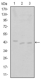 CDK9 Antibody - Western blot using CDK9 mouse monoclonal antibody against Jurkat (1), A431 (2) and HEK293 (3) cell lysate.