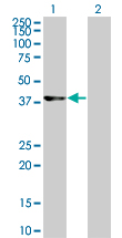 CDK9 Antibody - Western Blot analysis of CDK9 expression in transfected 293T cell line by CDK9 monoclonal antibody (M07), clone 2D7.Lane 1: CDK9 transfected lysate(42.778 KDa).Lane 2: Non-transfected lysate.
