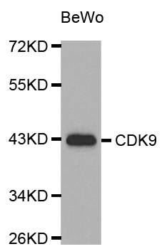 CDK9 Antibody - Western blot blot of extracts of Human placenta using CDK9 antibody.