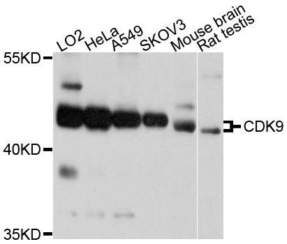 CDK9 Antibody - Western blot analysis of extracts of various cell lines, using CDK9 antibody at 1:1000 dilution. The secondary antibody used was an HRP Goat Anti-Rabbit IgG (H+L) at 1:10000 dilution. Lysates were loaded 25ug per lane and 3% nonfat dry milk in TBST was used for blocking. An ECL Kit was used for detection and the exposure time was 1s.
