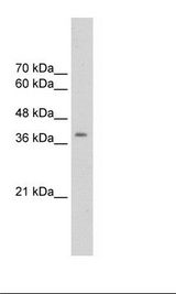 CDK9 Antibody - Transfected 293T Cell Lysate.  This image was taken for the unconjugated form of this product. Other forms have not been tested.