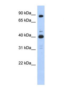 CDK9 Antibody - CDK9 antibody Western blot of 293T Cell lysate. Antibody concentration 1 ug/ml. This image was taken for the unconjugated form of this product. Other forms have not been tested.