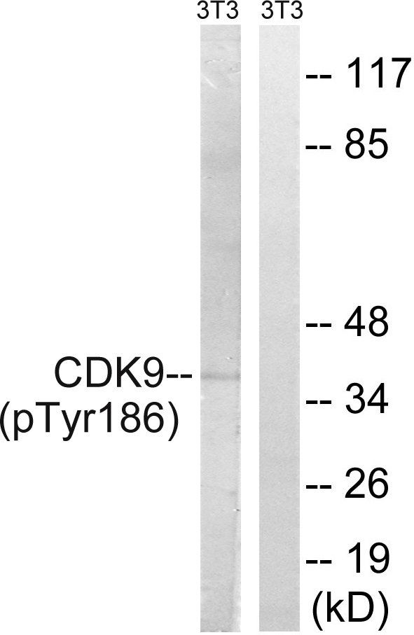 CDK9 Antibody - Western blot analysis of lysates from NIH/3T3 cells treated with Forskolin 40nM 30', using CDK9 (Phospho-Thr186) Antibody. The lane on the right is blocked with the phospho peptide.