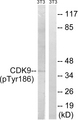 CDK9 Antibody - Western blot analysis of lysates from NIH/3T3 cells treated with Forskolin 40nM 30', using CDK9 (Phospho-Thr186) Antibody. The lane on the right is blocked with the phospho peptide.