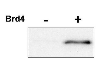 CDK9 Antibody - Anti-CDK9 pT29 Antibody - Western Blot. Western blot of affinity purified anti-CDK9 pT29 antibody shows detection of phosphorylated CDK9. 100 ng of purified P-TEFb, which contains CDK9 and its regulatory cyclin T1 subunit, was incubated with ATP in the presence or absence of Brd4, a protein known to induce CDK9 phosphorylation at T29. The primary antibody was used at a 1:1000 dilution. Personal Communication, J. Brady, NCI, Bethesda, MD.