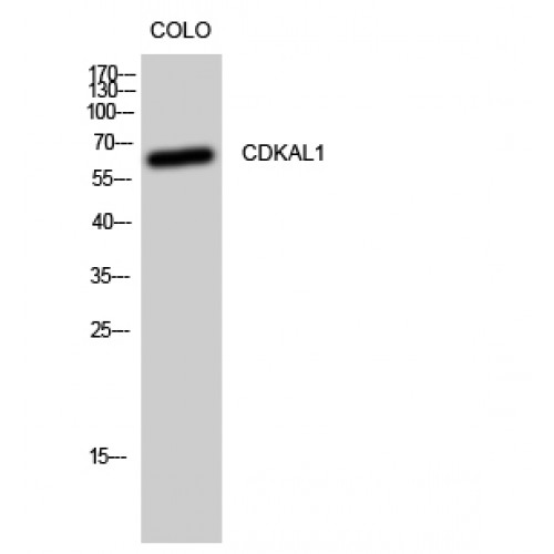 CDKAL1 Antibody - Western blot of CDKAL1 antibody