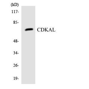 CDKAL1 Antibody - Western blot analysis of the lysates from HUVECcells using CDKAL antibody.