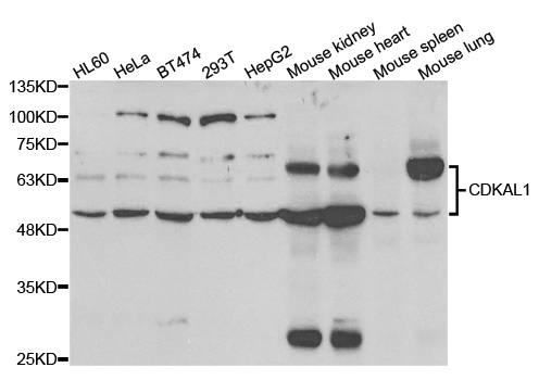 CDKAL1 Antibody - Western blot analysis of extracts of various cell lines.